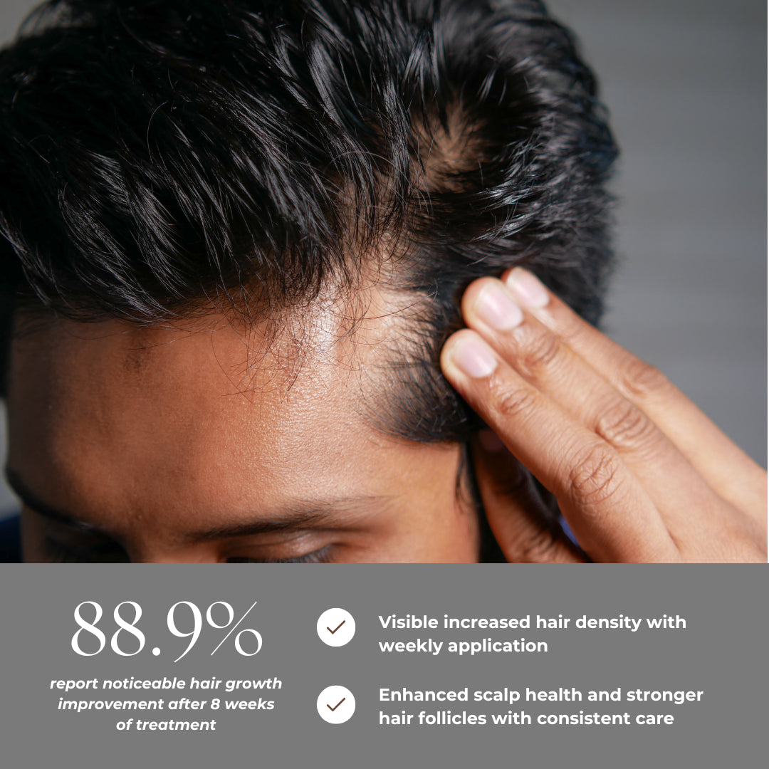 Microneedling Hair Regrowth System