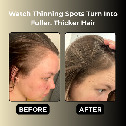 Micro Infusion System