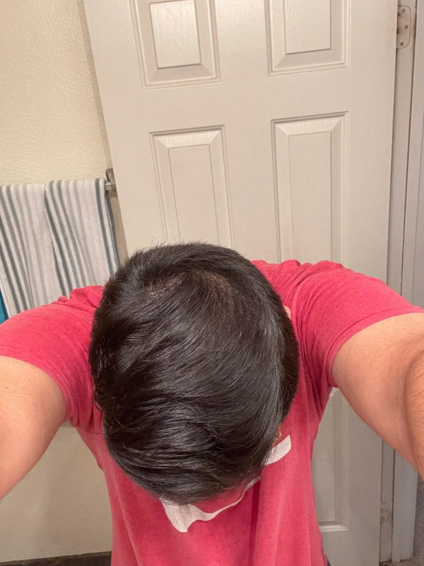 Customer crown after 16 weeks of weekly TREVO use