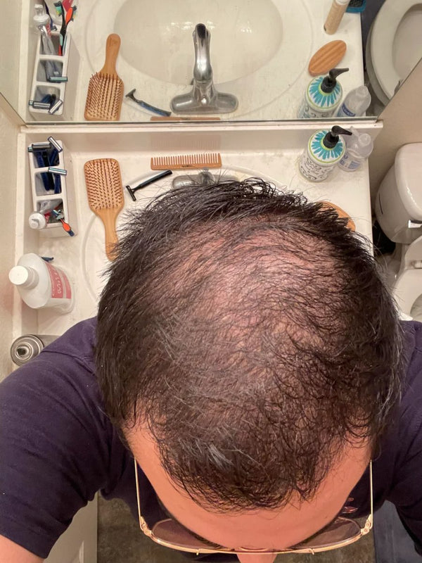 Customer crown before TREVO