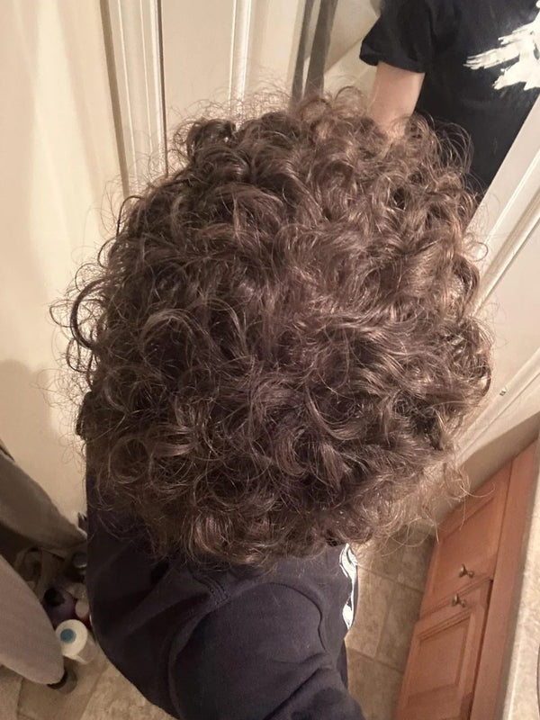 Customer crown after 24 weeks of weekly TREVO use
