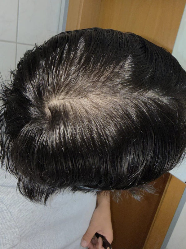 Customer crown after 20 weeks of weekly TREVO use