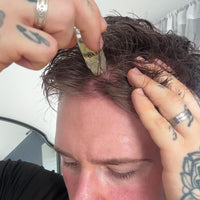 Customer stamping his hairline with the TREVO micro-infusion device